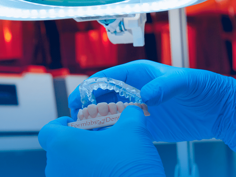 Guia oclusal impressa em 3D com a resina Dental LT Clear V2